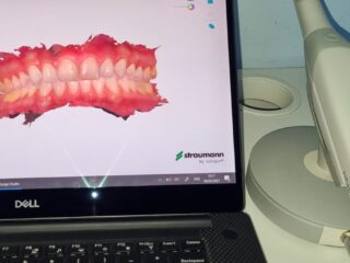 https://mydentanet.co.uk/wp-content/uploads/2021/11/Digital-dentistry-320x240-1.jpeg